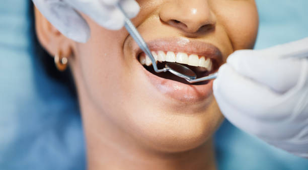 Best Emergency Dental Care for Broken or Chipped Teeth in Lowellville, OH