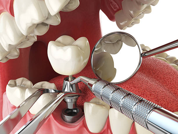 Best Emergency Gum Treatment in Lowellville, OH